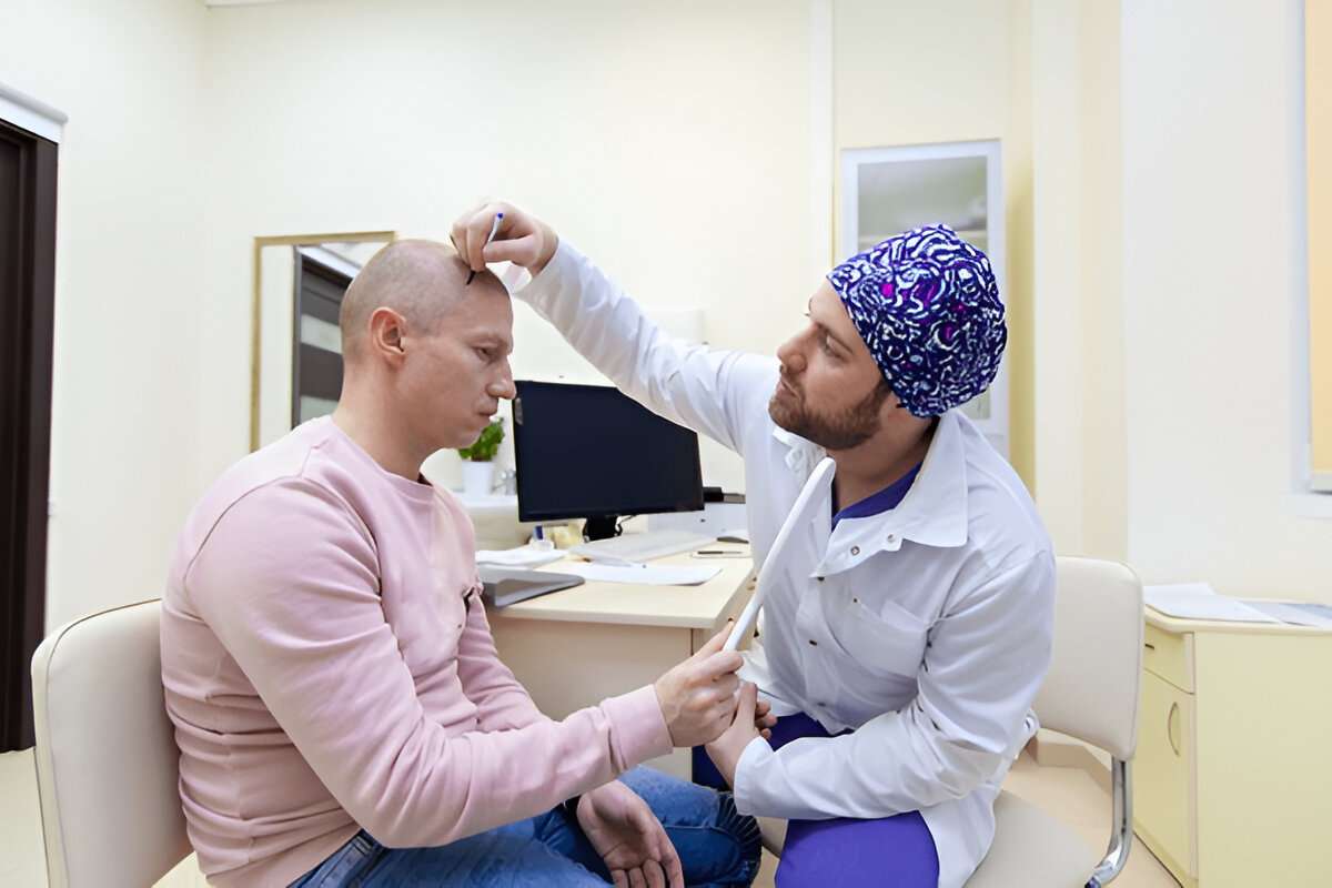hair transplant